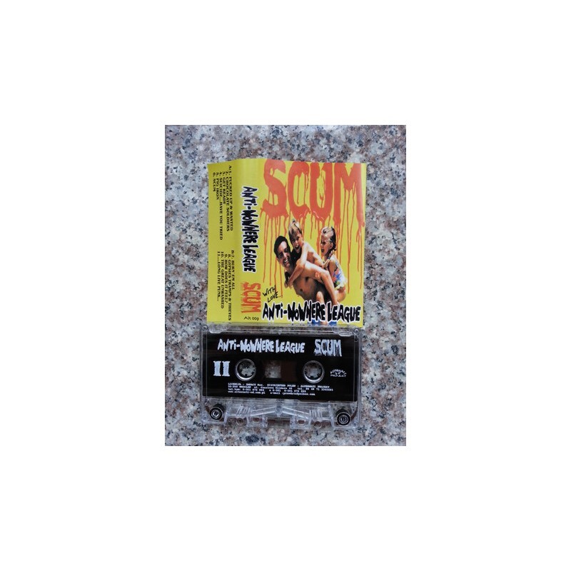 UŻ-MC. Anti-Nowhere League 